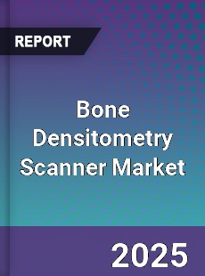 Global Bone Densitometry Scanner Industry