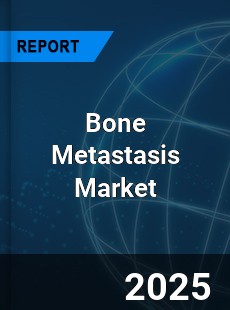 COVID 19 Outbreak Global Bone Metastasis Industry