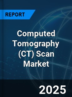 Global Computed Tomography Scan Market