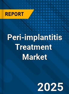 Global Peri implantitis Treatment Market