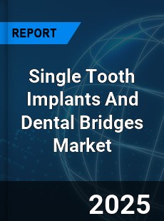 Global Single Tooth Implants And Dental Bridges Market